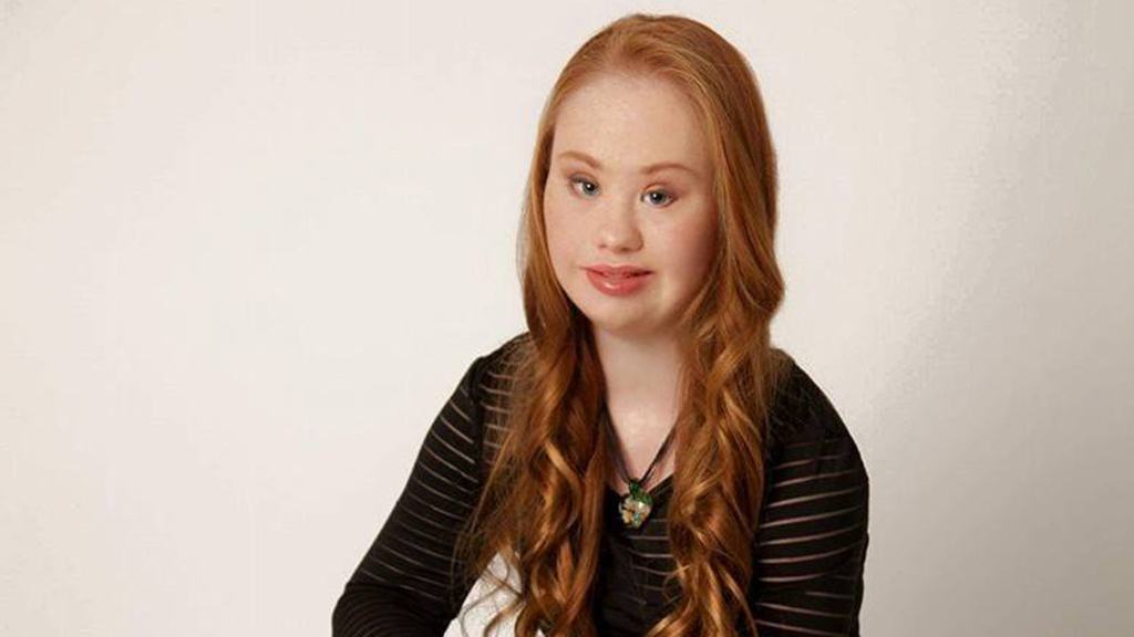 Diversità VS perfezione: Madeline Stuart, la giovane modella con sindrome Down