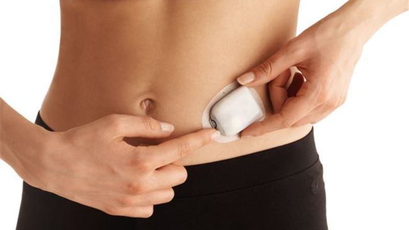 Mylife Omnipod Handling