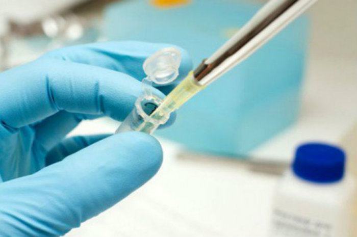 Tumori del pancreas, dalla Calabria ricerca con importanti risultati