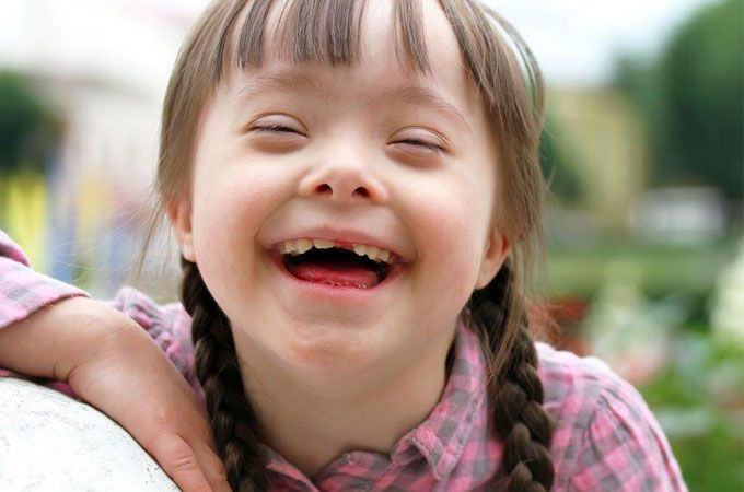 Giornata mondiale sindrome di Down: AIPD Reggio Calabria presena un nuovo progetto