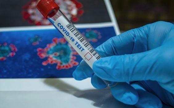 Tampone Coronavirus