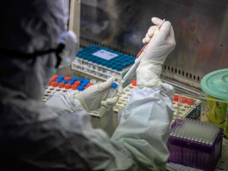 Covid 19 Epidemic Medical Research And Test Facility