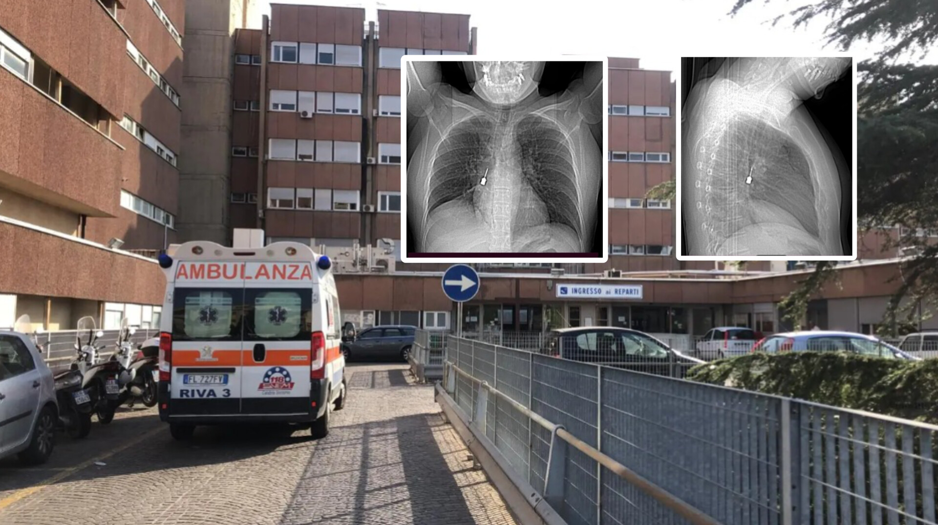 intervento gom reggio calabria cacciavite